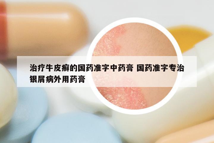 治疗牛皮癣的国药准字中药膏 国药准字专治银屑病外用药膏