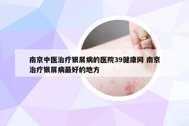 南京中医治疗银屑病的医院39健康网 南京治疗银屑病最好的地方