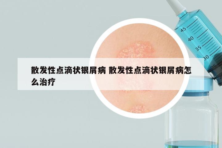 散发性点滴状银屑病 散发性点滴状银屑病怎么治疗