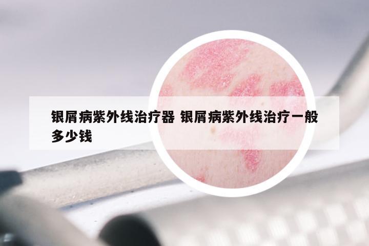 银屑病紫外线治疗器 银屑病紫外线治疗一般多少钱