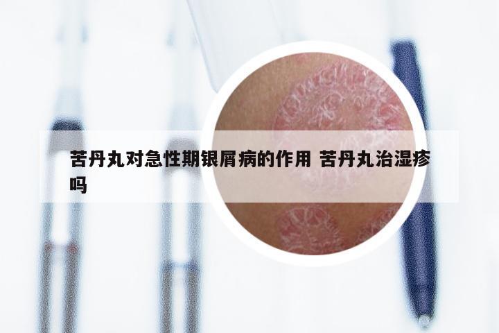 苦丹丸对急性期银屑病的作用 苦丹丸治湿疹吗