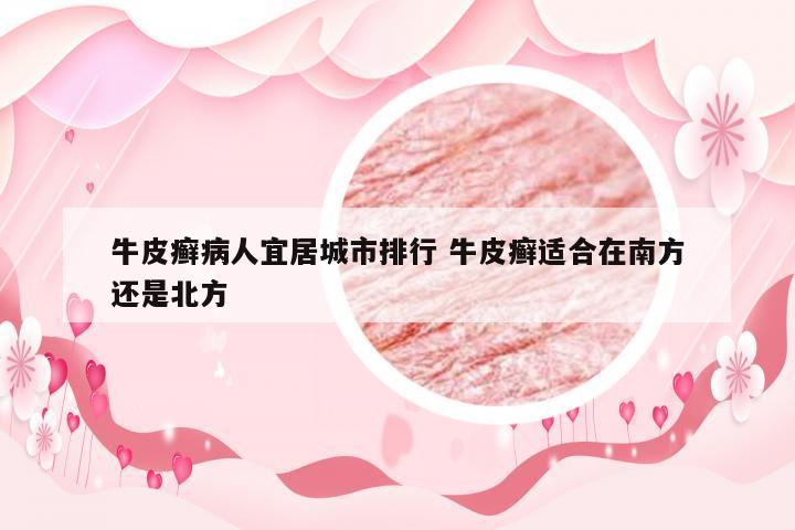 牛皮癣病人宜居城市排行 牛皮癣适合在南方还是北方