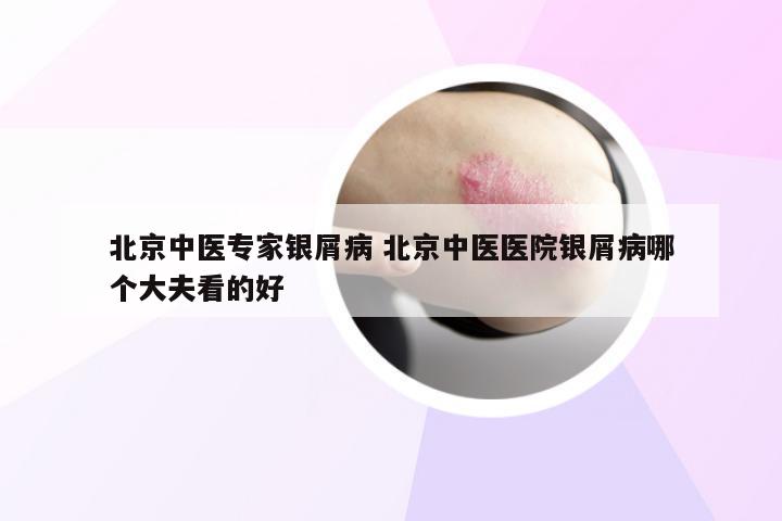 北京中医专家银屑病 北京中医医院银屑病哪个大夫看的好