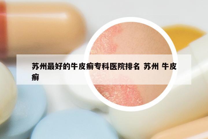苏州最好的牛皮癣专科医院排名 苏州 牛皮癣