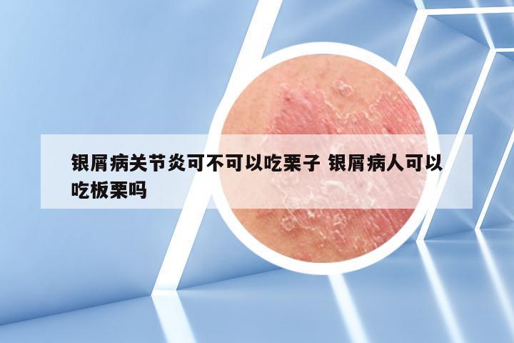 银屑病关节炎可不可以吃栗子 银屑病人可以吃板栗吗