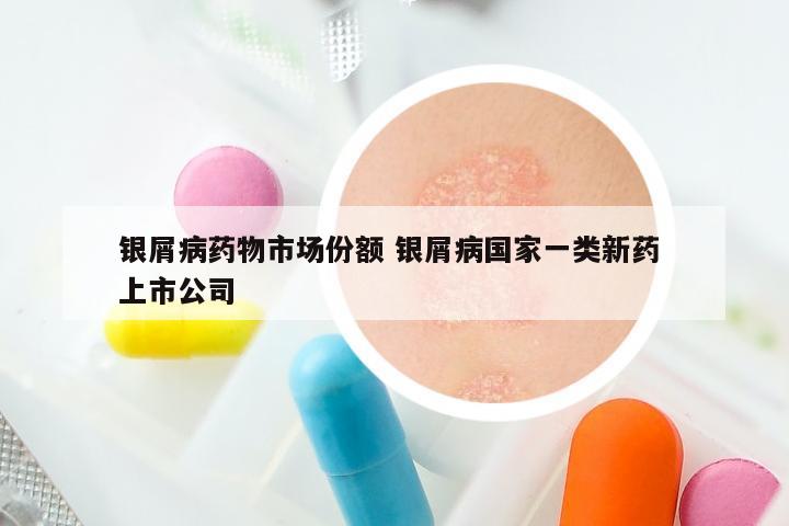银屑病药物市场份额 银屑病国家一类新药 上市公司
