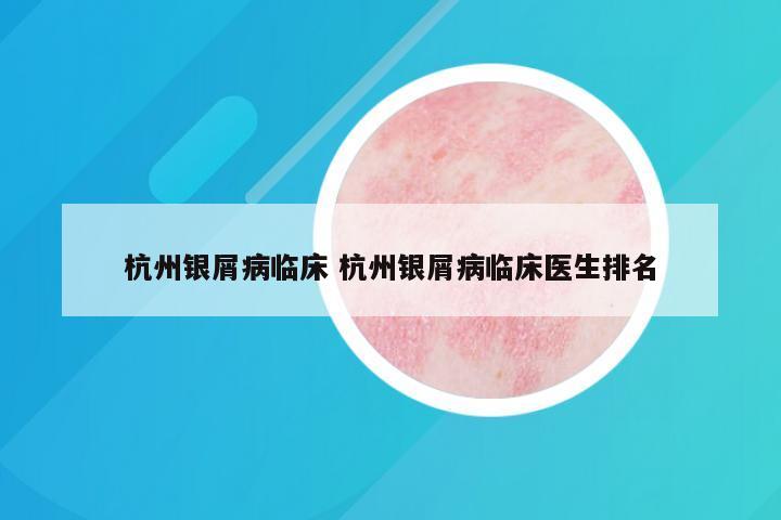 杭州银屑病临床 杭州银屑病临床医生排名
