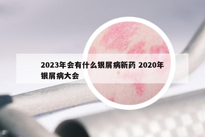 2023年会有什么银屑病新药 2020年银屑病大会