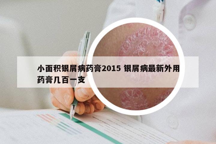 小面积银屑病药膏2015 银屑病最新外用药膏几百一支