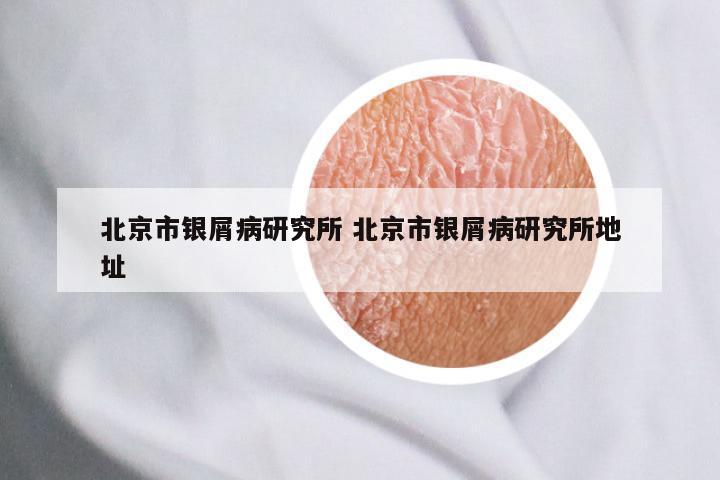 北京市银屑病研究所 北京市银屑病研究所地址