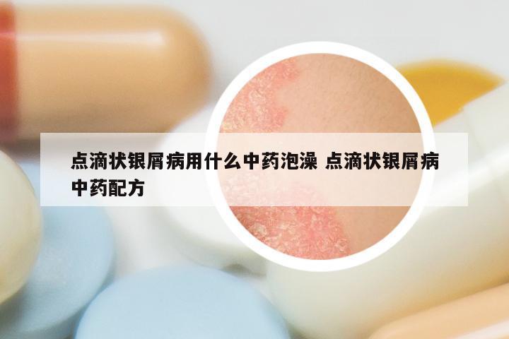 点滴状银屑病用什么中药泡澡 点滴状银屑病中药配方