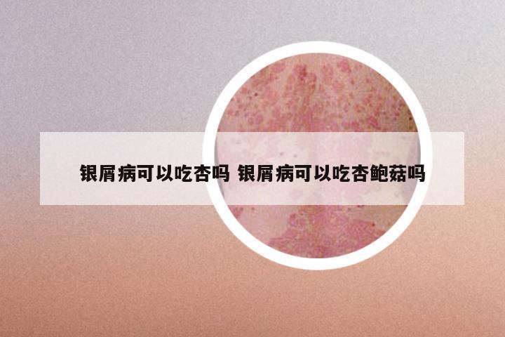 银屑病可以吃杏吗 银屑病可以吃杏鲍菇吗