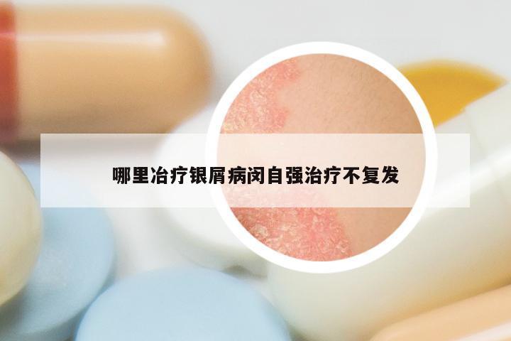 哪里冶疗银屑病闵自强治疗不复发