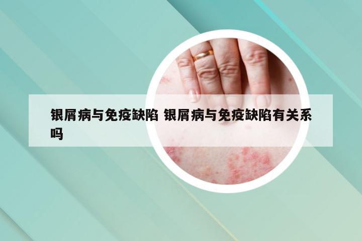银屑病与免疫缺陷 银屑病与免疫缺陷有关系吗
