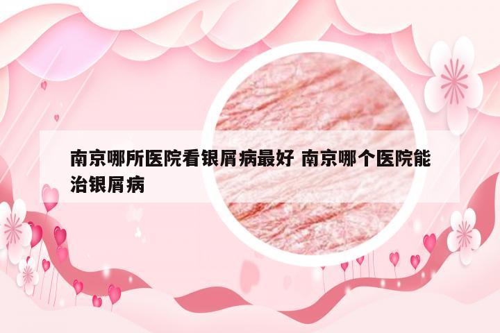 南京哪所医院看银屑病最好 南京哪个医院能治银屑病