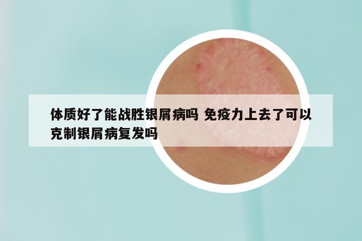 体质好了能战胜银屑病吗 免疫力上去了可以克制银屑病复发吗
