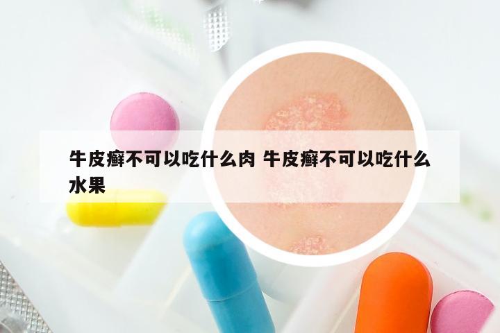 牛皮癣不可以吃什么肉 牛皮癣不可以吃什么水果
