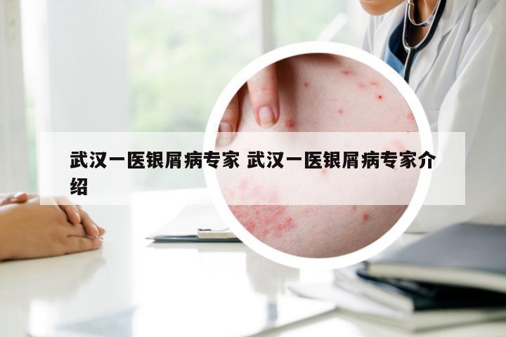 武汉一医银屑病专家 武汉一医银屑病专家介绍