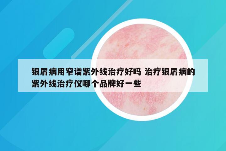 银屑病用窄谱紫外线治疗好吗 治疗银屑病的紫外线治疗仪哪个品牌好一些