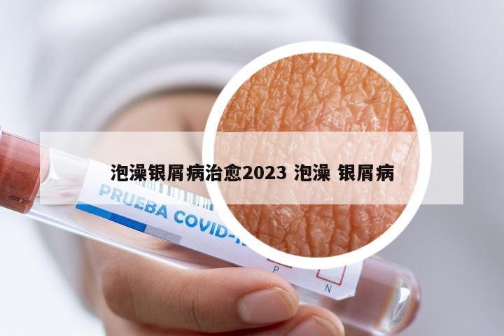 泡澡银屑病治愈2023 泡澡 银屑病
