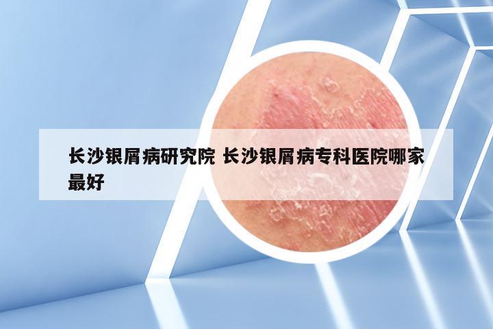 长沙银屑病研究院 长沙银屑病专科医院哪家最好