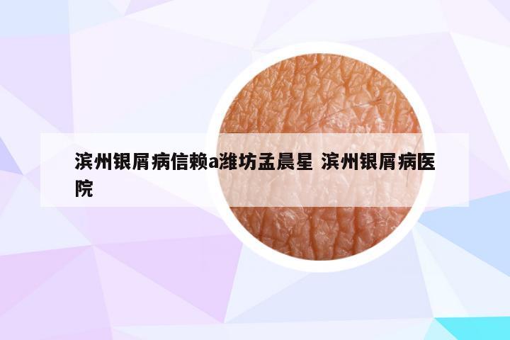 滨州银屑病信赖a潍坊孟晨星 滨州银屑病医院