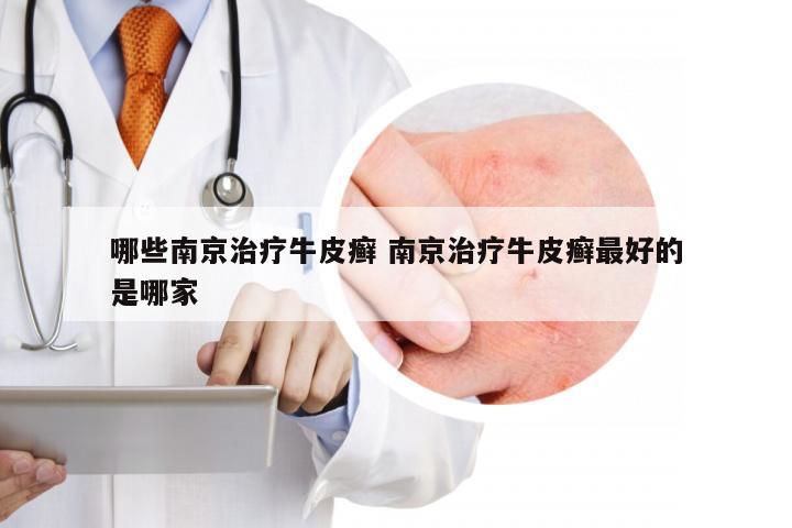 哪些南京治疗牛皮癣 南京治疗牛皮癣最好的是哪家