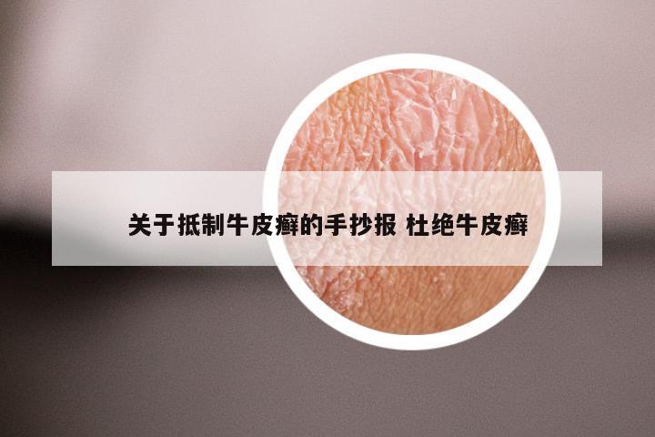 关于抵制牛皮癣的手抄报 杜绝牛皮癣
