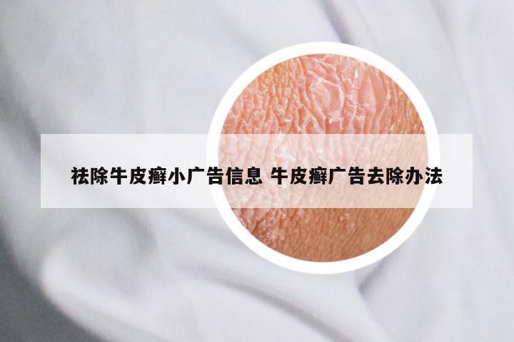 祛除牛皮癣小广告信息 牛皮癣广告去除办法