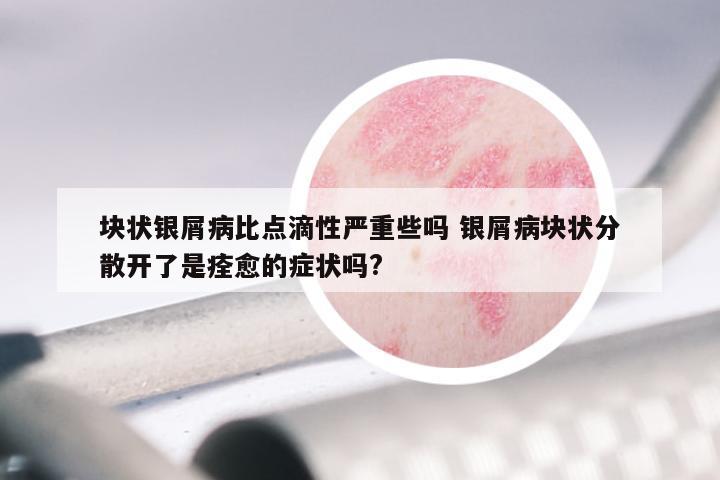 块状银屑病比点滴性严重些吗 银屑病块状分散开了是痊愈的症状吗?