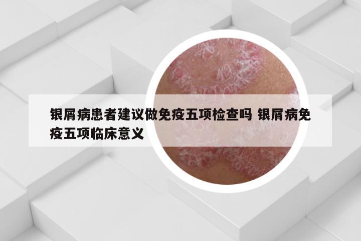 银屑病患者建议做免疫五项检查吗 银屑病免疫五项临床意义