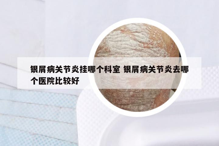 银屑病关节炎挂哪个科室 银屑病关节炎去哪个医院比较好