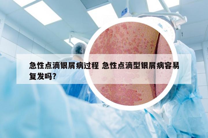 急性点滴银屑病过程 急性点滴型银屑病容易复发吗?