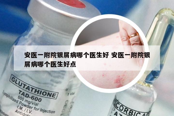 安医一附院银屑病哪个医生好 安医一附院银屑病哪个医生好点